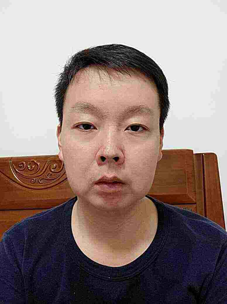 头像